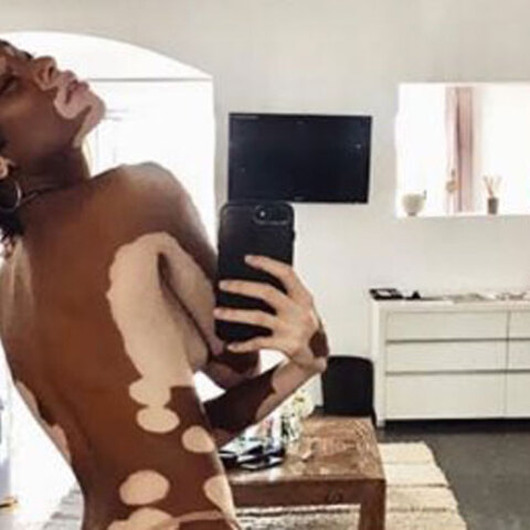Winnie Harlow για το Sports Illustrated 