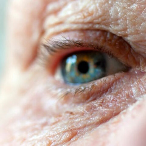 Διάγνωση της νόσου Αλτσχάιμερ