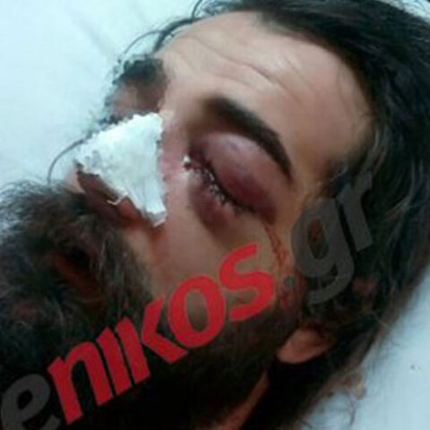 Καταγγελία φιλάθλου