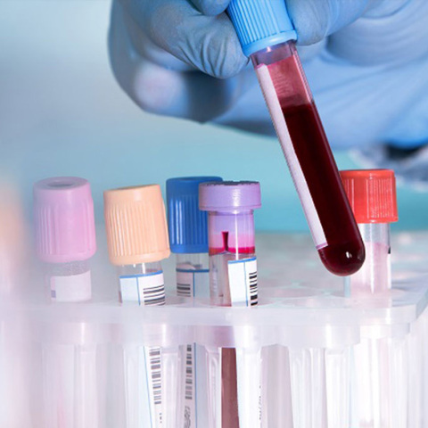 Εξέταση αίματος