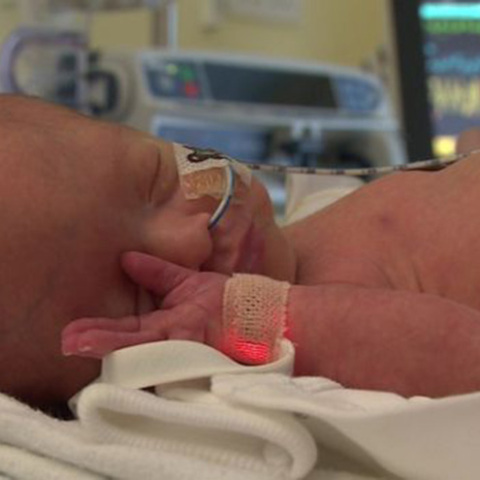 Μωρό Τζάκσον