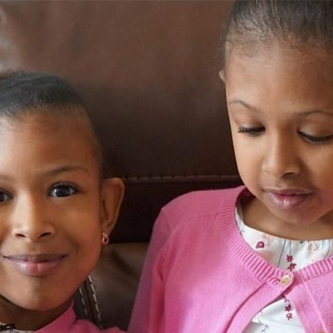 Σιαμαία κοριτσάκια