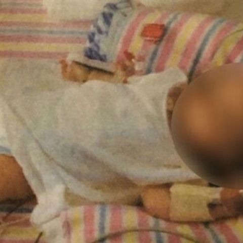 Γονείς υπέβαλαν σε αυστηρή vegan διατροφή την 19 μηνών κόρη τους 