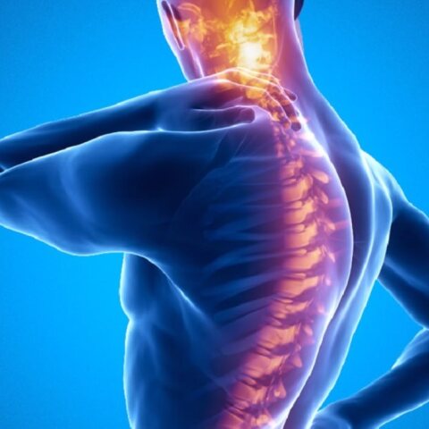 ankylosing-spondylitis.jpg