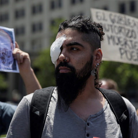 Διαδηλωτές με οφθαλμικά τραύματα στη Χιλή 