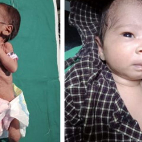 Το μωρό που βρέθηκε θαμμένο ζωντανό στην Ινδία