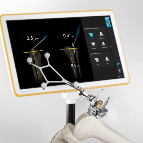 Πρωτοποριακό σύστημα ρομποτικής πλοήγησης στην Ευρωκλινική Αθηνών