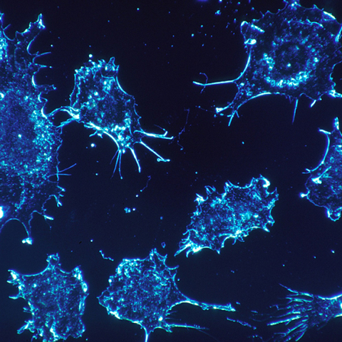cancer-cells-541954_1920.jpg
