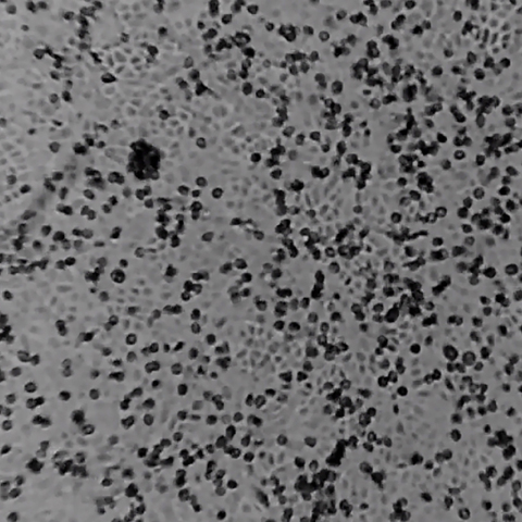 Η εργαστηριακή εκδοχή του κοροναϊού /