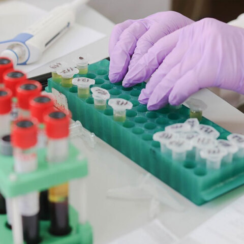 Κύπρος: Συνεχίζονται οι εξετάσεις δειγμάτων για κορωνοϊό