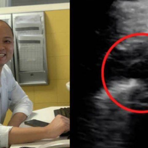 Γιατρός με κορωνοϊό στη Μαδρίτη 