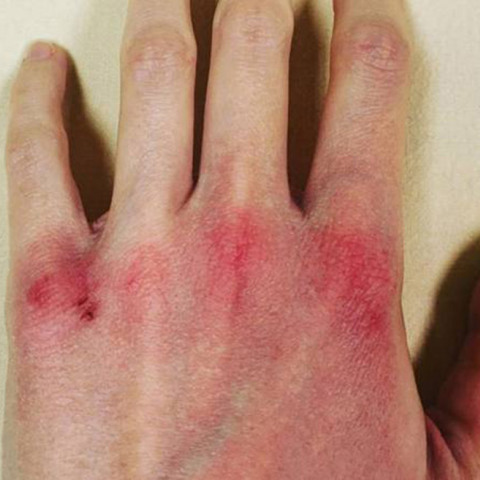 Κορωνοϊός - Φλωρεντία - νοσηλεύτρια