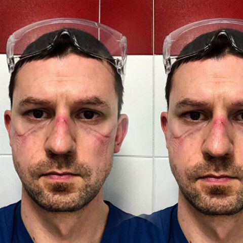 Συγκλονίζει η selfie του Ιταλού γιατρού για τον κορωνοϊό