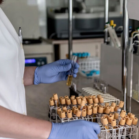 Σε κατάσταση συναγερμού λόγω κορωνοϊού οι υγειονομικές υπηρεσίες της Ρουμανίας