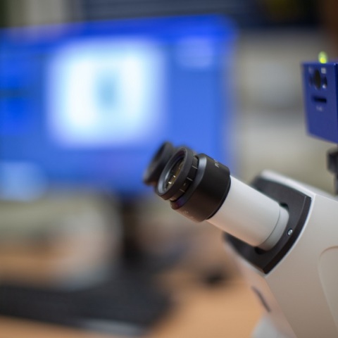 ΕΟΔΥ και ΕΚΠΑ ενισχύουν την εργαστηριακή διερεύνηση και επιτήρηση κρουσμάτων λοίμωξης από τον κορωνοϊό