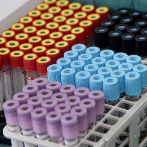 Περισσότερα τεστ για τον κορωνοϊό ζητεί το ΚΙΝΑΛ 