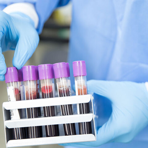 Κορωνοϊός, Έρευνα