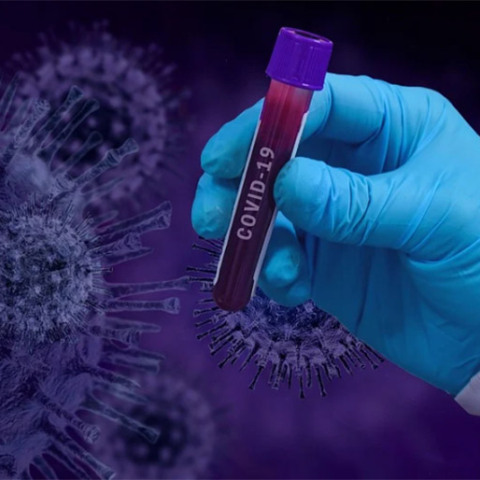 Κορωνοϊός, τεστ