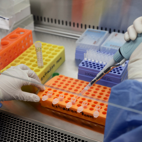 Κορωνοϊός: 18 υποψήφια εμβόλια υπό δοκιμή 