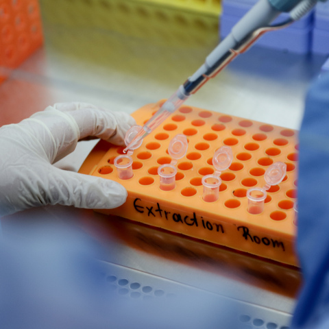 Κορωνοϊός: ΟΙ ΗΠΑ εγκρίνουν ως φάρμακο τη ρεμδεσιβίρη