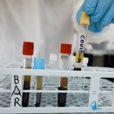 ΗΠΑ: Ο κορωνοϊός δεν φτιάχτηκε από άνθρωπο 