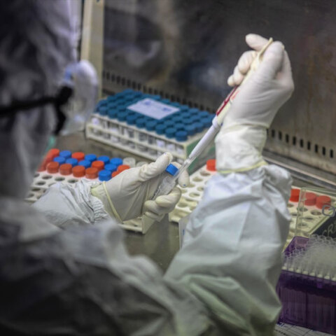 Το τελευταίο 24ωρο στις ΗΠΑ πέθαναν περισσότεροι από 1.000 ασθενείς με κορωνοϊό