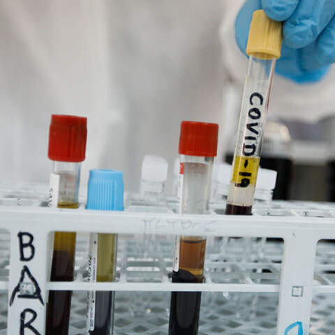 Κορωνοϊός στην Ελλάδα