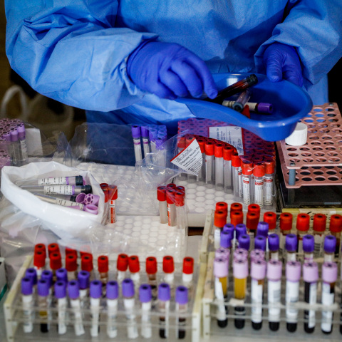 Κορωνοϊός: Νεότερα δεδομένα από την ανάπτυξη εμβολίων 