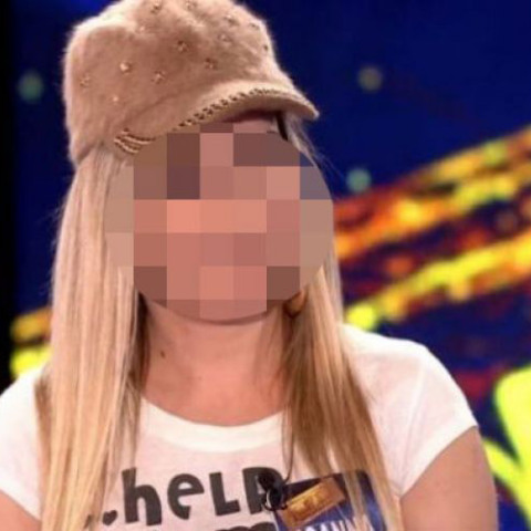 Η 34χρονη που δέχτηκε επίθεση με καυστικό υγρό στην Καλλιθέα