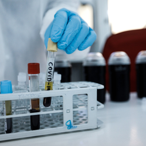 Γιατί η πανδημία απείλησε τους ασθενείς με καρδιαγγειακά προβλήματα 