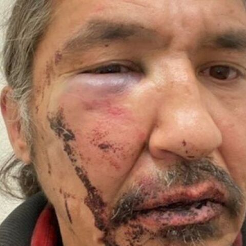 Καναδάς, Αστυνομική βία