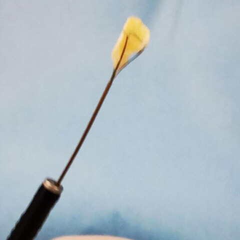 Ένα καρύδι παραλίγο να σκοτώσει τον μικρό Οδυσσέα από την Πάτρα 