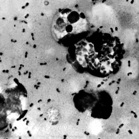 Βακτήρια βουβωνικής πανώλης 