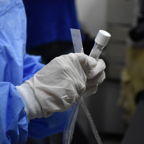 Διαγνωστικά τεστ ανίχνευσης covid-19