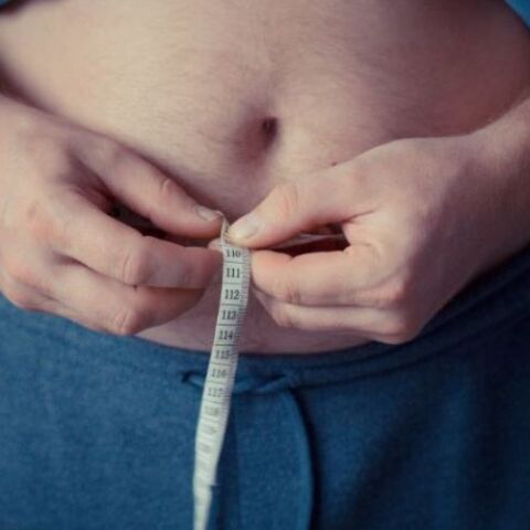 Παχυσαρκία