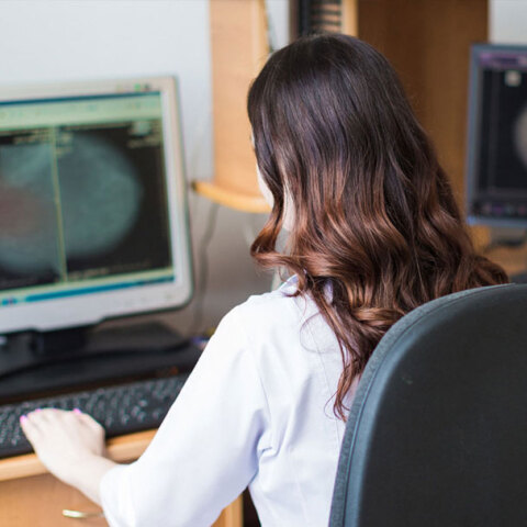 Μαστογραφία