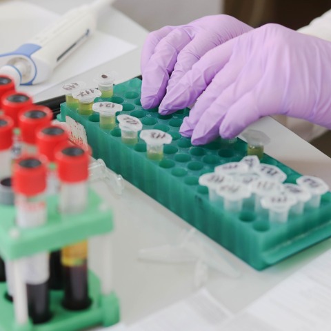 Νέα δεδομένα στη θεραπεία του καρκίνου του οισοφάγου 