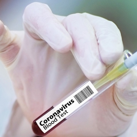 Εμβόλιο - Covid 19