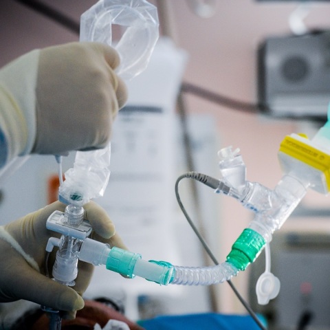 Στιγμιότυπο από την ΜΕΘ 