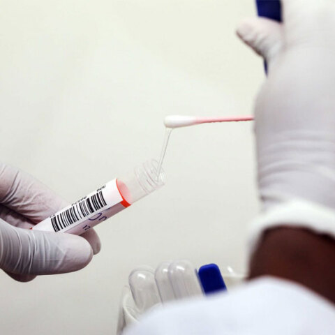 Κλινικές δοκιμές σε εμβόλιο για τον κορωνοϊό 