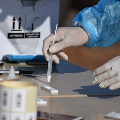 Τεστ για τον κορωνοϊό