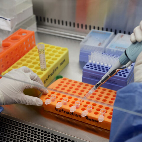 Εμβόλιο για τον κορωνοϊό - Κλινικές δοκιμές