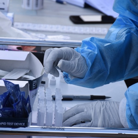 ΕΟΔΥ - Τεστ για κορωνοϊό