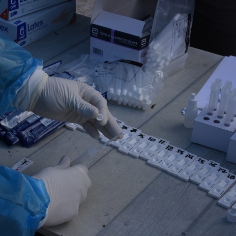 ΕΟΔΥ - Τεστ για κορωνοϊό