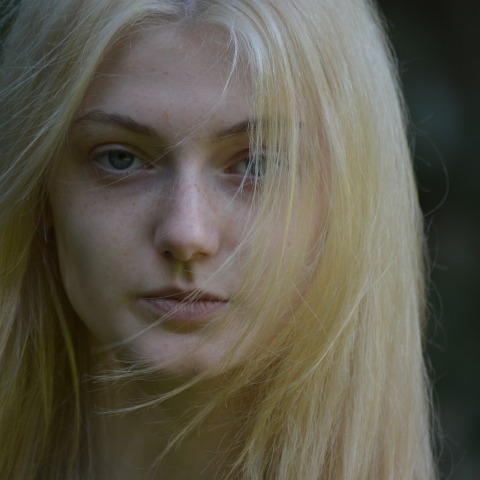 Ακμή των ενηλίκων: Πού μπορεί να οφείλεται 