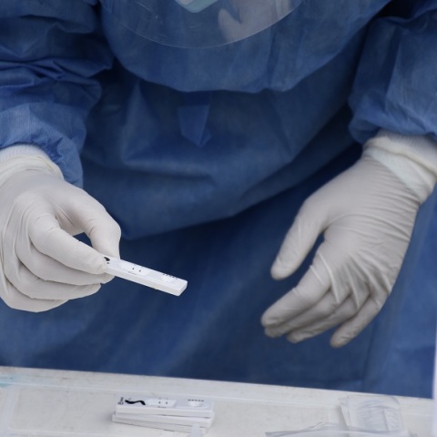 ΕΟΔΥ - Τεστ για κορωνοϊό