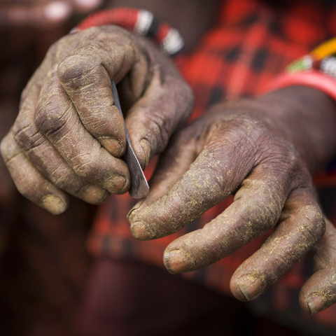 Όταν τα κορίτσια τρέχουν να γλιτώσουν από την κλειτοριδεκτομή 