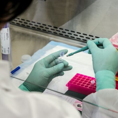 Επιστήμονας σε εργαστήριο μελετά τον κορωνοϊό