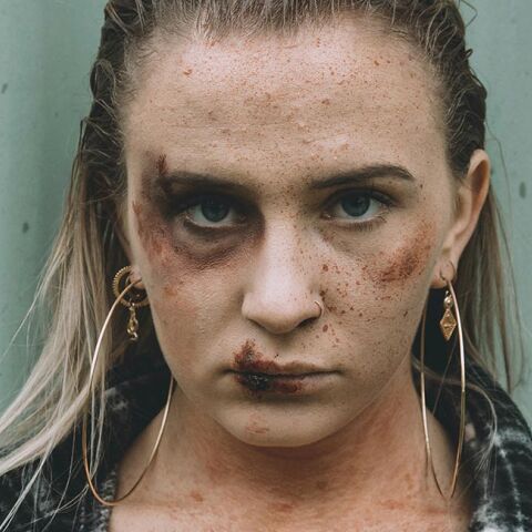 Κακοποιημένη γυναίκα