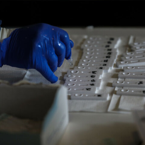 Rapid test (ΦΩΤΟ ΑΡΧΕΙΟΥ) - Σε 34 σημεία διενεργούνται δωρεάν αύριο Σάββατο 10 Ιουλίου 2021